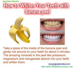 whiten your teeth